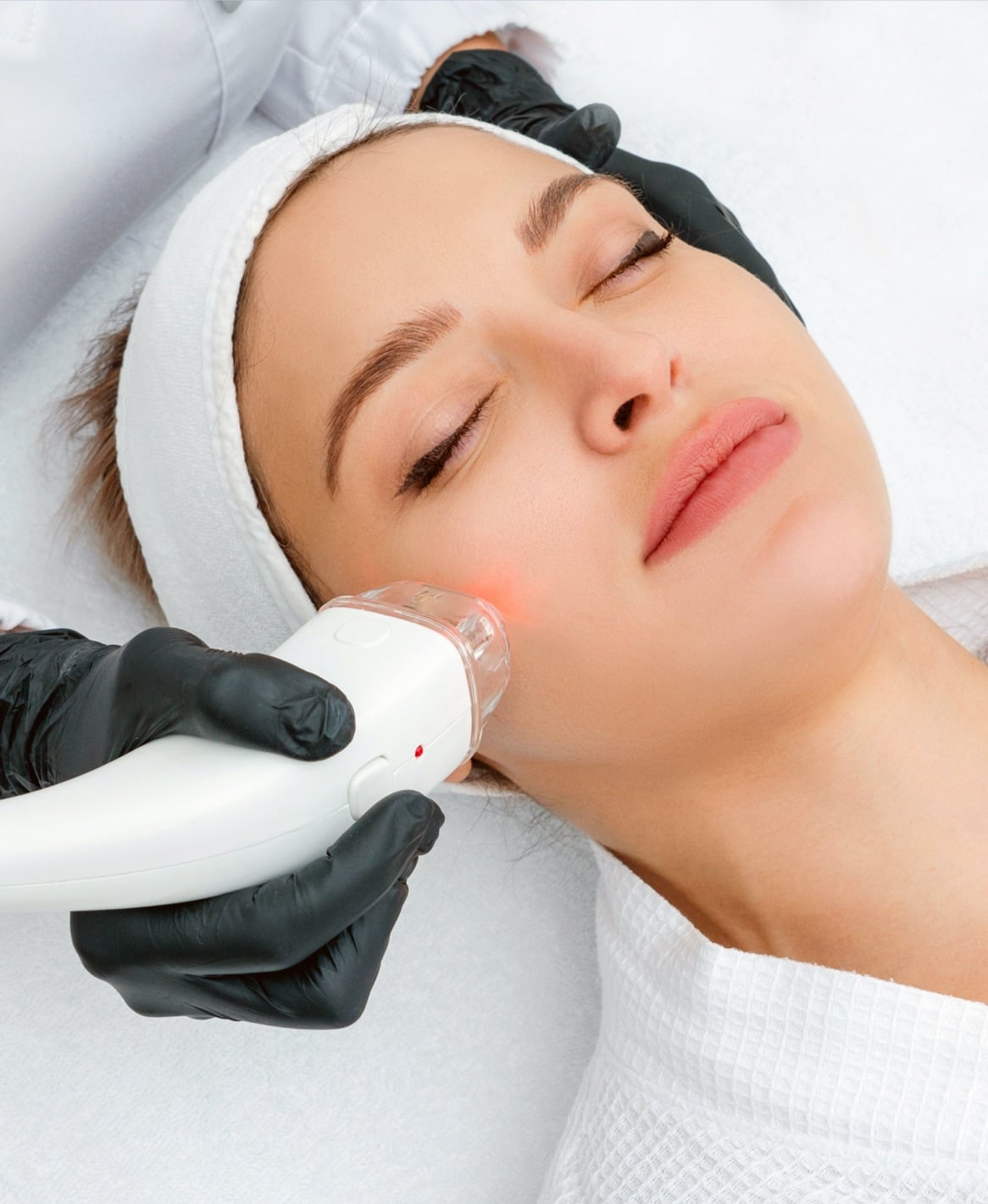 Laser Treatments